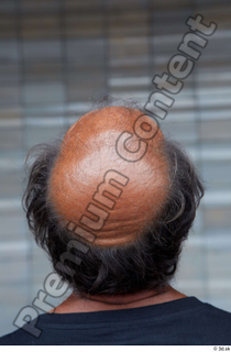 Street  637 bald hair head 0003.jpg